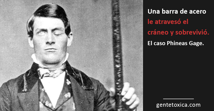 phineas gage
